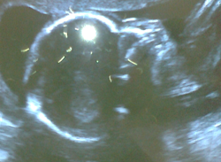 https://www.solideogloria.es/articulos-de-opinion/aborto-la-vuelta-al-pasado
